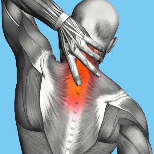 What Are Symptoms Of Tight Fascia?